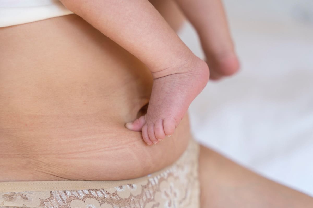 Bauch nach Schwangerschaft mit Babyfüssen